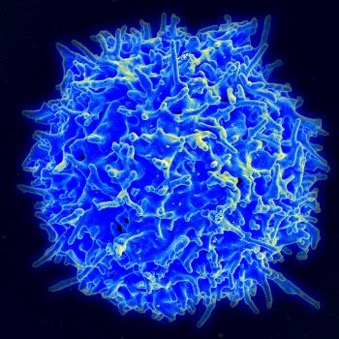 Autoimmune Diseases_0